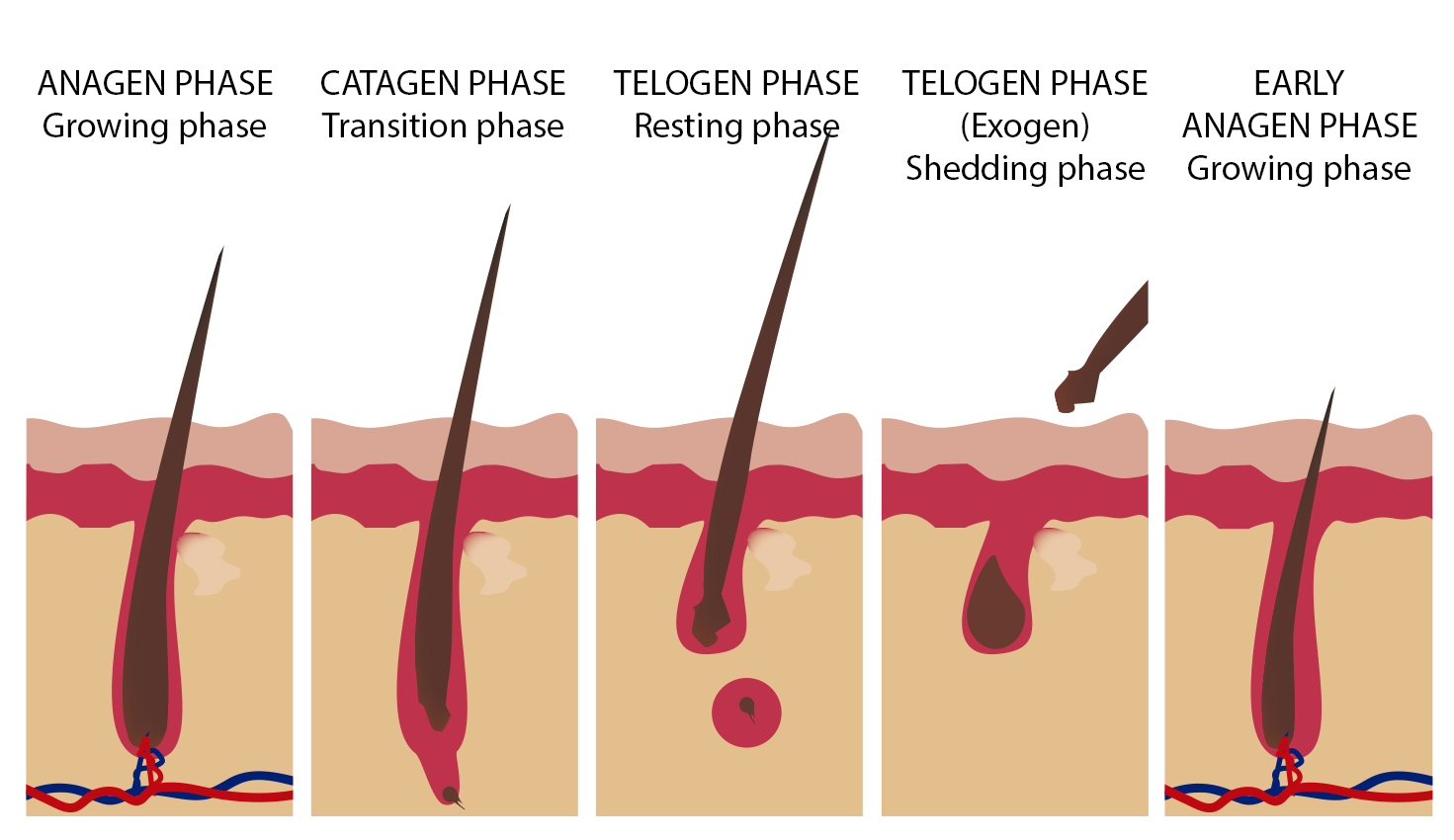 Fases de la caída del pelo - redenhair