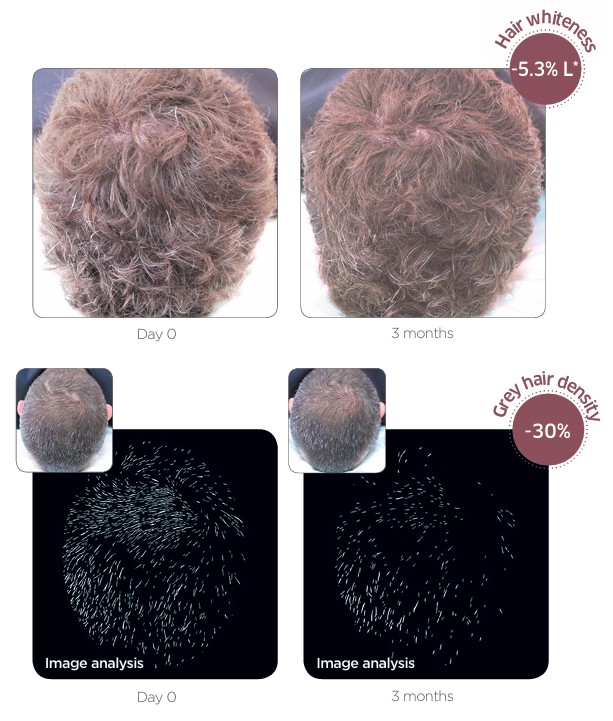 Greyverse: Antes/después real del estudio, repigmentación global y reducción de canas