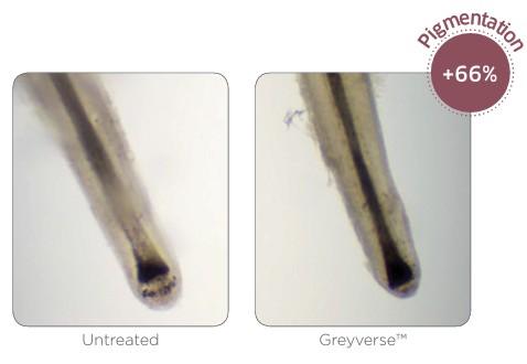 Greyverse: menos melaninización y una pérdida de pigmento